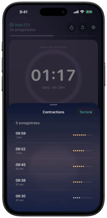 Historique des contractions avec points d'intensité